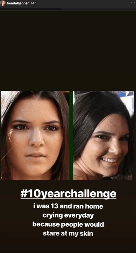 Proactiv Stands Behind Kendall Jenners Acne Marketing Campaign