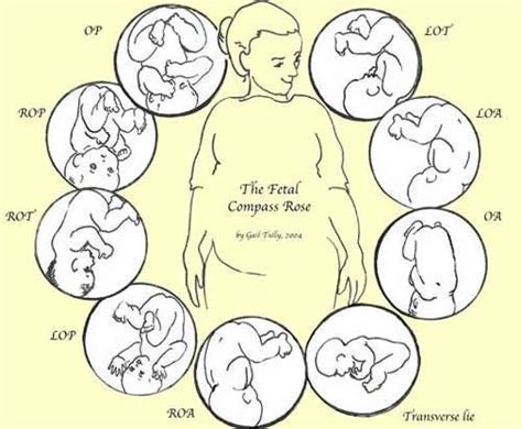 Achieve Optimal Fetal Positioning And Pelvic Tilt Demonstration — The