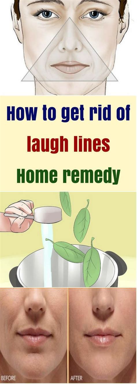 How To Get Rid Of Laugh Lines Home Remedy All What You Need Is Here Laugh Lines Health