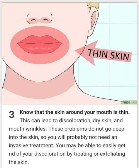 Skin Discoloration Around Lips Lipstutorial Org