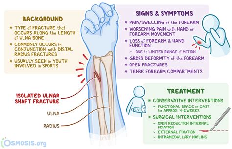 Distal Ulna Fracture What Is It Management And More Osmosis