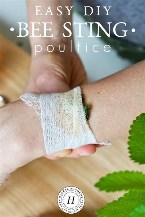 Easy Diy Bee Sting Poultice Herbal Academy Natural Remedies