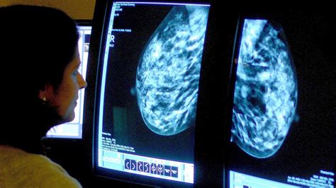 Incurable Breast Cancer Patients Face Repeated Gp Visits Before