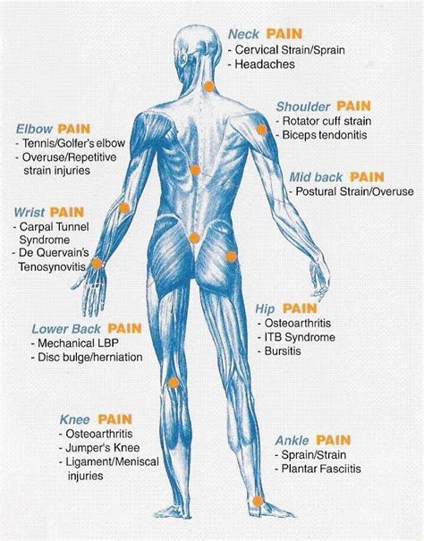 Pain Diagram Of Body