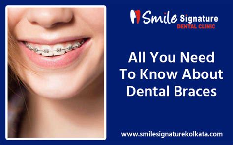 All You Need To Know About Dental Braces Smile Signature Dental Clinic
