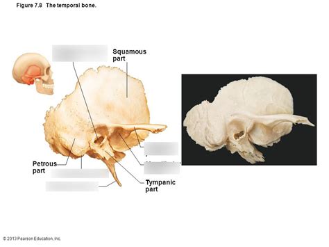 Temporal Bone Diagram Quizlet