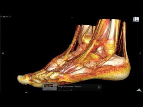 Muscle was closely related to the volume of all foot muscles determined by mri as described above. CT scan Foot ：アキレス腱 - YouTube