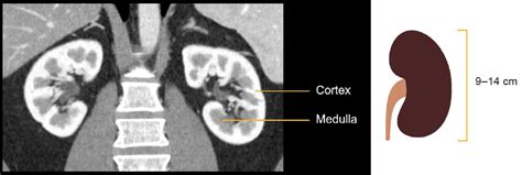 Abdominal Ct Genitourinary System • Litfl • Radiology