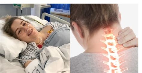 23χρονη έπαθε εγκεφαλικό όταν τέντωσε τον λαιμό της για να κάνει κρακ