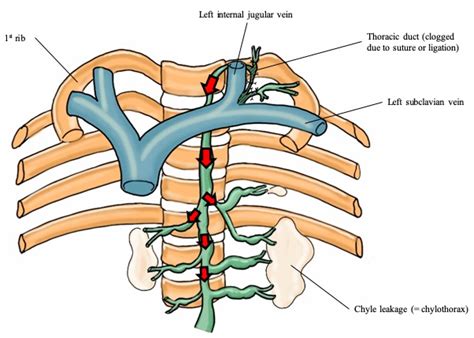 Thoracic Duct Neck