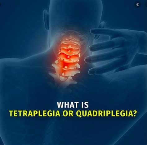 What Is Tetraplegia And Is It Different From Quadriplegia