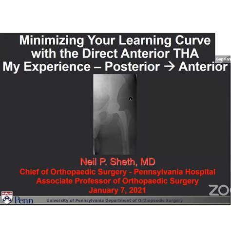 Minimising Your Learning Curve With Direct Anterior Total Hip