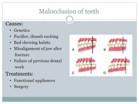 dentist best dental clinic in vasundhara what do you mean by malocclusion dr malvika jain
