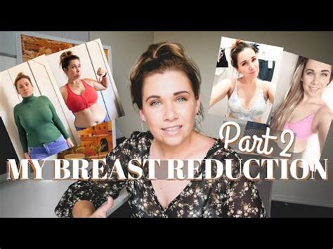 Breast Reduction Part Post Op Australia Plastic Surgery Recovery