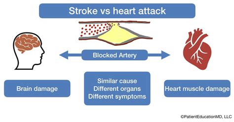 Stroke Vs Heart Attack Patienteducationmd