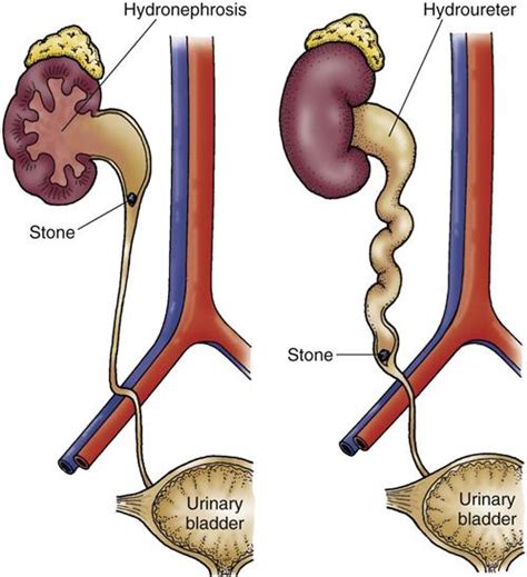 Care Of Patients With Renal Disorders Nurse Key