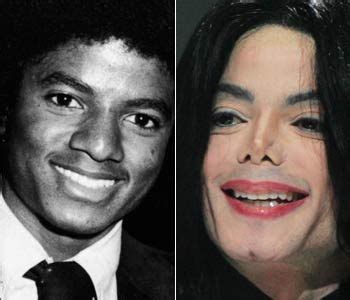Michael Jacksons Nose Before And After