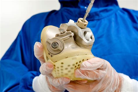 Worlds First Artificial Heart Transplant On A Female Shows Promising