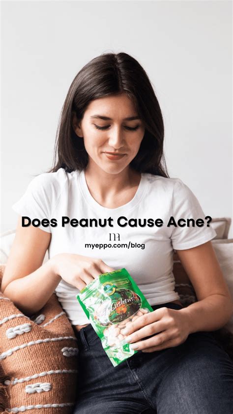 Does Peanut Cause Acne Myeppo