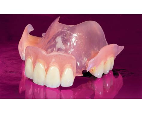 Clinical Performance Of Removable Partial Dentures A