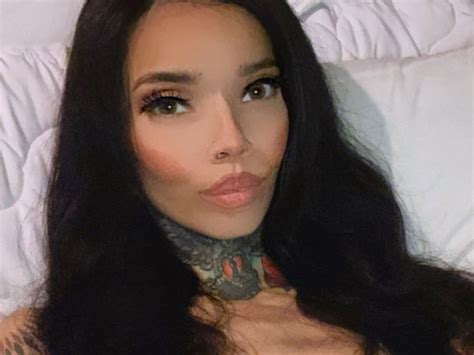 Ig Model Who Is Hiv Positive Blind Again After Eye Surgery
