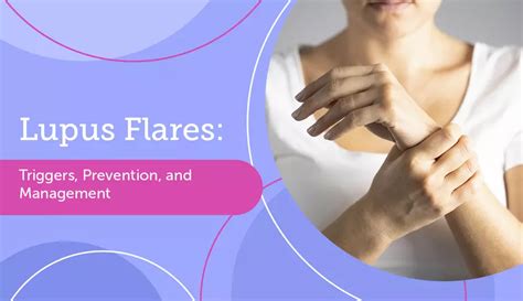 Lupus Flares Triggers Prevention And Management Mylupusteam
