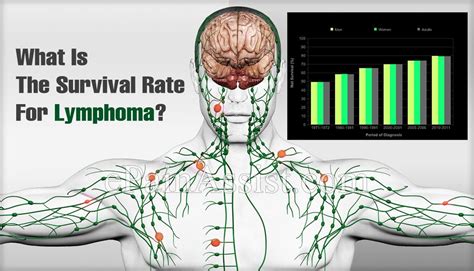 What Is The Survival Rate Of Non Hodgkins Lymphoma