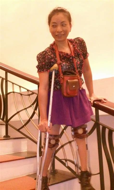 Pin By Dianne Dych On Polio 2 Braces Girls Leg Braces Fashion