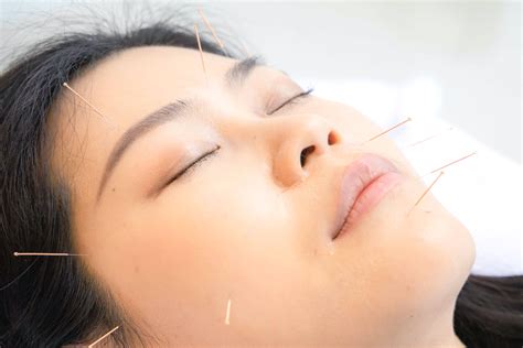 Facial Rejuvenation Renew Acupuncture Houston
