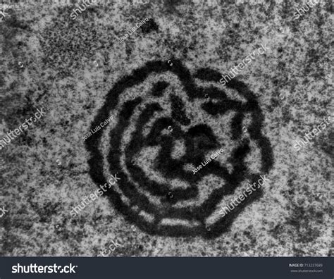 Electron Microscope Micrograph Showing Nucleolus Atypical Foto Stok
