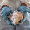 Meth Plus Opioids New Hazards Of Dual Addiction Shots Health News