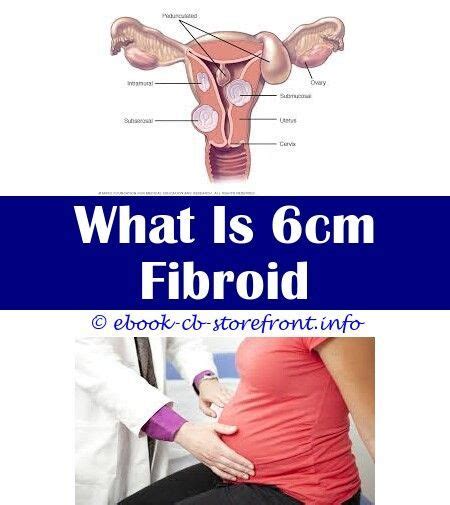 How To Remove Fibroids Without Surgery