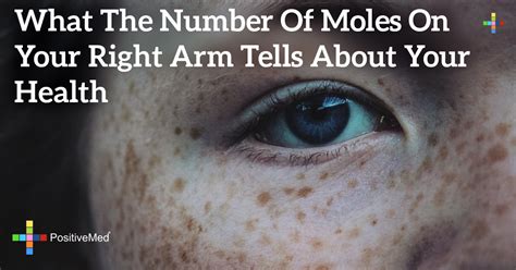 What The Number Of Moles On Your Right Arm Tells About Your Health Positivemed