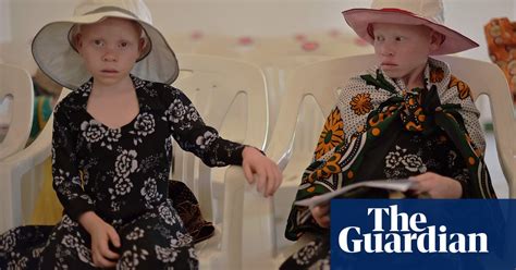 International Albinism Awareness Day In Pictures World News The