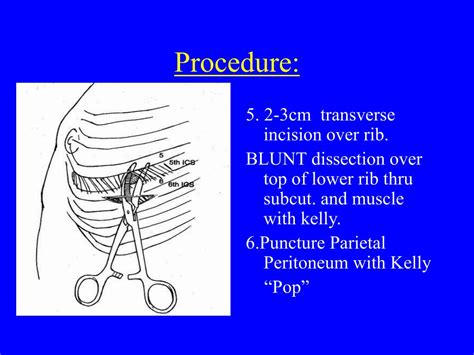 Ppt Chest Tube Insertion Powerpoint Presentation Free Download Id
