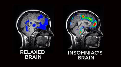 how experts say a good night s sleep affects the brain kptm