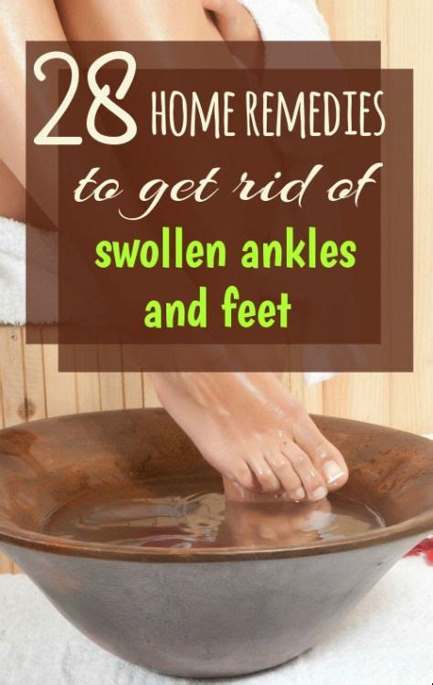 28 Home Remedies For Feet And Ankle Swelling Foot And Ankle Swelling