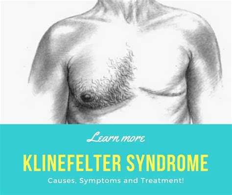 Klinefelter Syndrome Causes Symptoms And Treatment