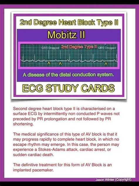 2nd Degree Heart Block Mobitz 2 Medical Surgical Nursing Nursing