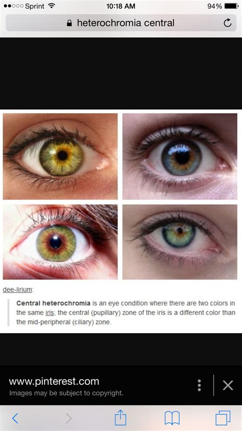 Hazel Eye Color Genetics Chart