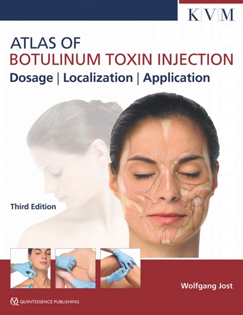 Atlas Of Botulinum Toxin Injection Archidemia