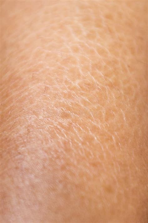 Dry And Cracked Skin Textures Close Up Stock Photo Image 22629560