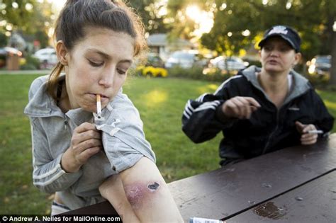 Krokodil Two Sisters Claim To Be Proof That Russian Flesh Eating Drug Is Being Used In U S