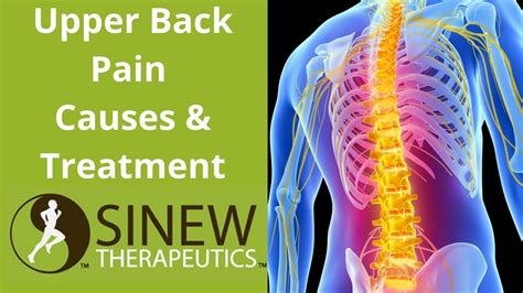 Upper Back Pain Causes And Treatment Youtube