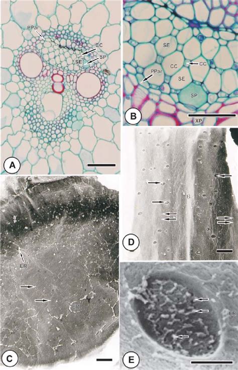 A And B Show Details Of A Deep Seated Vascular Bundle From The Stem