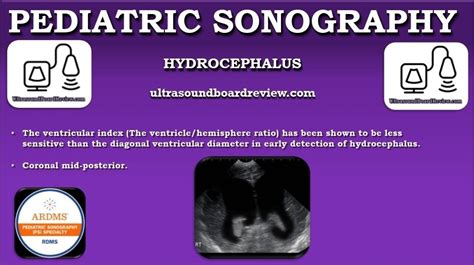 Pin On Pediatric Sonography