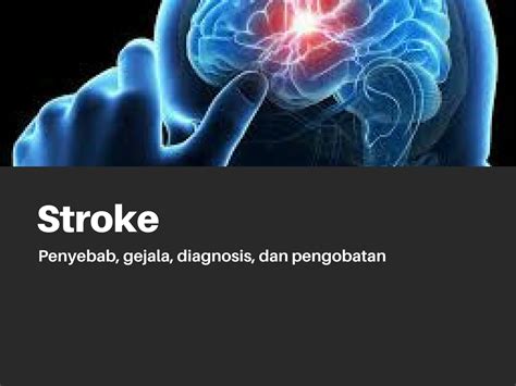 Stroke Penyebab Gejala Diagnosis Dan Pengobatan Medianers