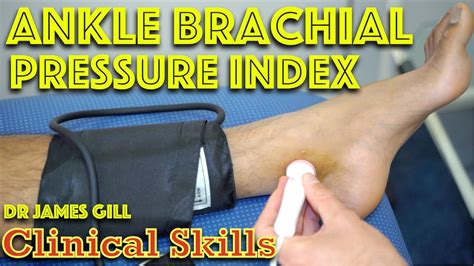 How To Measure Abpi Ankle Brachial Pressure Index Clinical