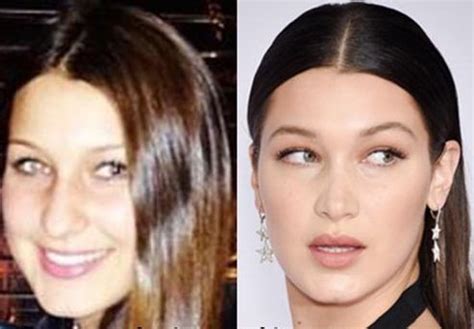 However, in 2010, most of the people did not probably recognize her by name or by face either until recently where she has started garnering major attention for the plastic surgeries she has gone through. Bella Hadid Plastic Surgery (1) - Celebrity plastic ...