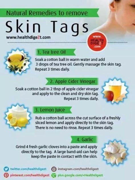Skin Tag Removal Guide This Infographic Details How To Remove Skin